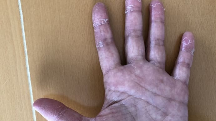 パクリタキセル2クール目