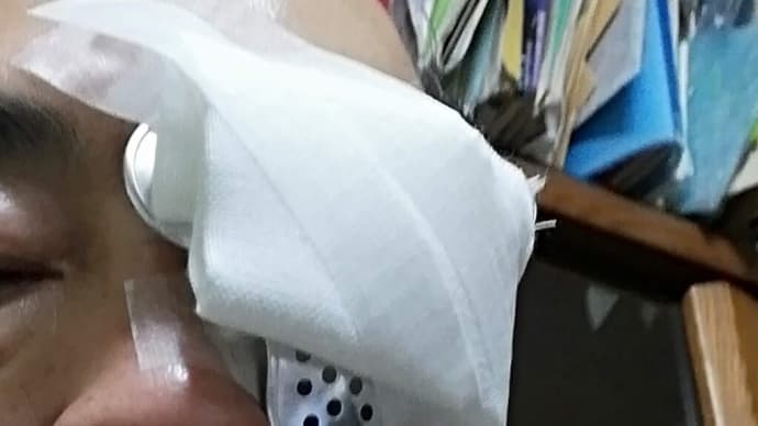 主夫のブログ 白内障手術