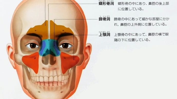 副鼻腔炎による嗅覚異常、鼻づまり、クチ呼吸、を治癒するハルチタンチップ