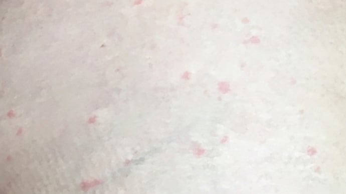 乳がん転移の治験に参加した