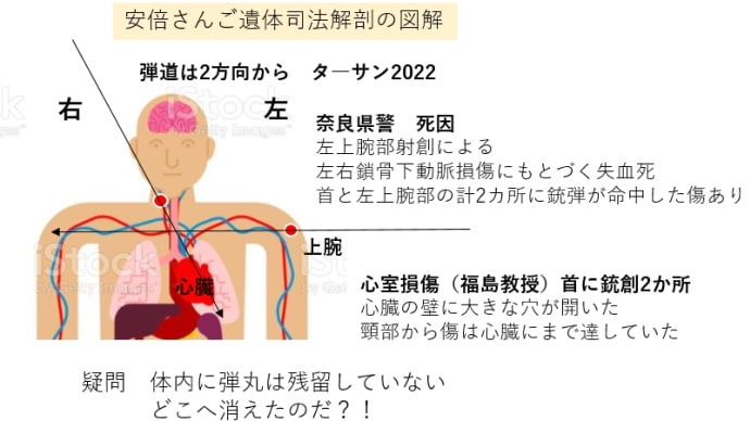安倍晋三総理銃撃の2発目が発見去れていません。山上徹也は、陽動で真犯人が狙撃した可能性は、常に考えて置いた方が良いでしょう。