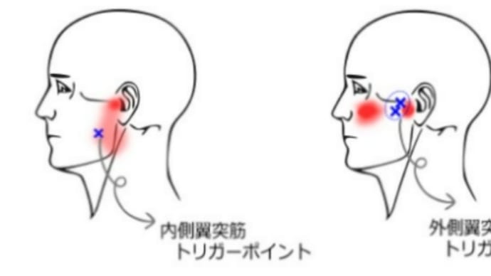 歯の痛みはマスクのせい!?