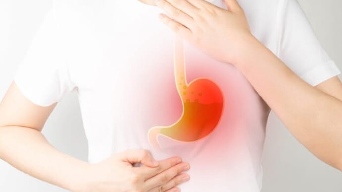胃がんには多くの誘因がある 胃を守るためのヒント