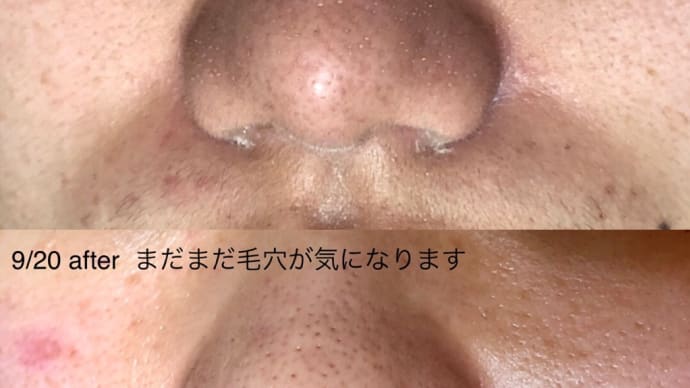 お肌が綺麗になると化粧が薄くなる