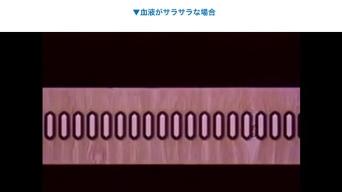 【大祓詞】に描写されている「罪を祓う」場面。〜「血流」には梅エキス(ムフラメール)、浄化作用=抗酸化作用〜
