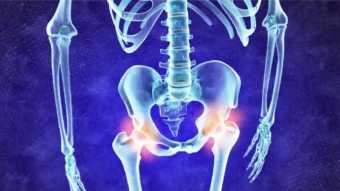 変形性関節症は治せる? 700の遺伝子が導く未来医療