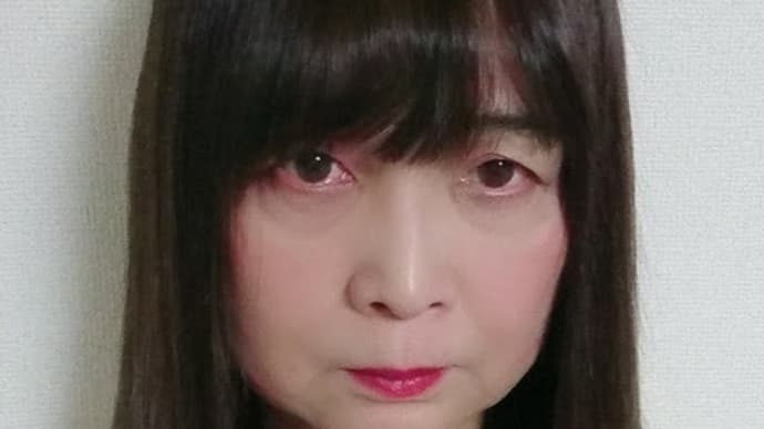 お昼休みにブラケットが取れて急遽矯正歯科に通院でした☆
