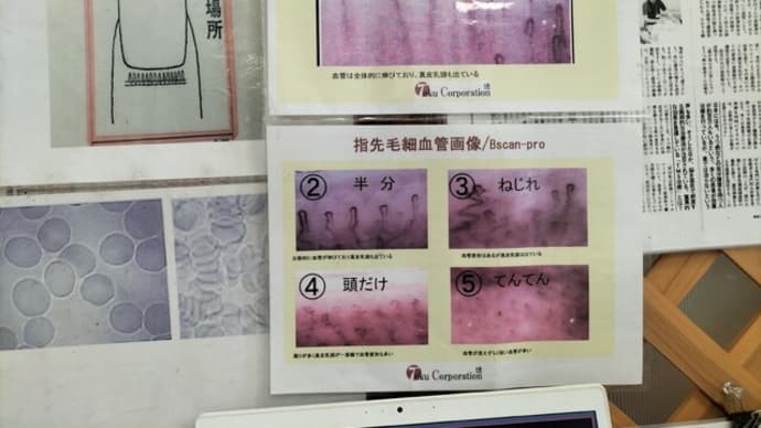 血流測定会