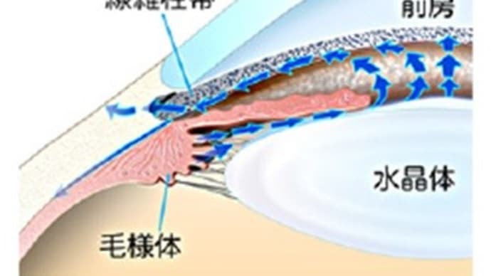目薬に代わる、新しい緑内障眼圧下降治療②