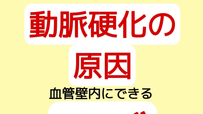 動脈硬化の原因「血管内にできるコブ」