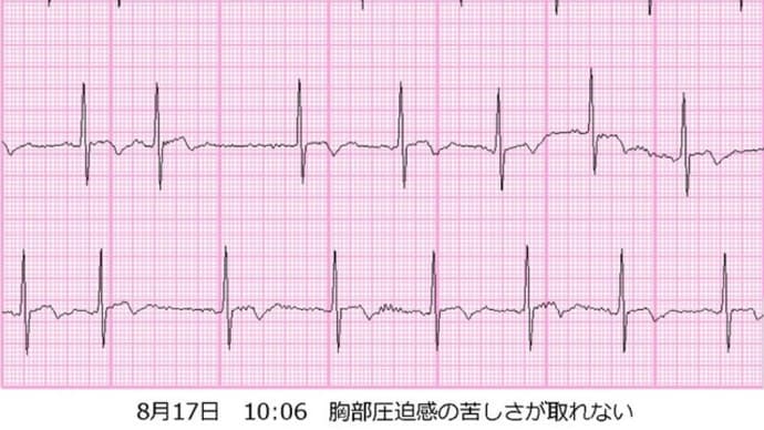 あ～病院ではあんなに体調良かったのになあ