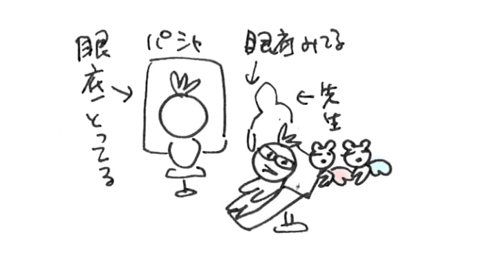 今度は、後部硝子体剥離だってー。