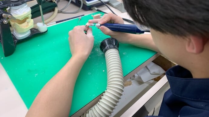 部分床義歯がいよいよ完成間近!