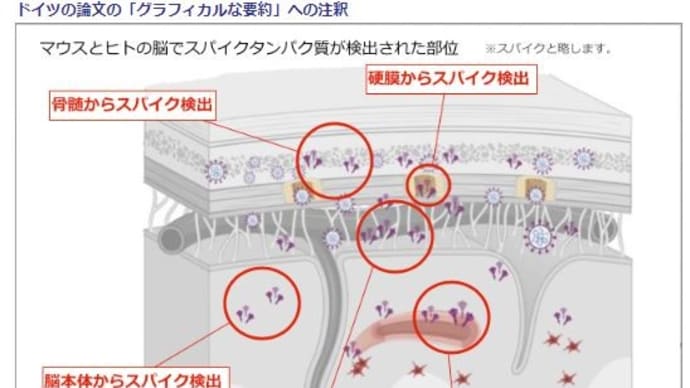 スパイクタンパク質は、脳のあらゆる部位から検出され、それらは一様に脳組織を破壊していた