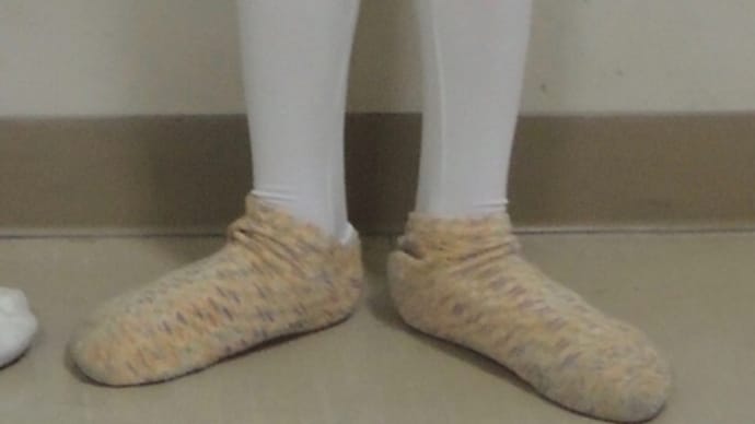 線維性骨異形成症〈大学病院1〉「腫瘍があります」