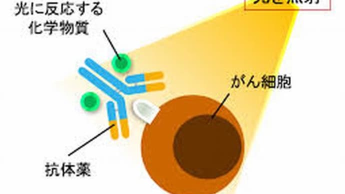 『ガンの光免疫療法』