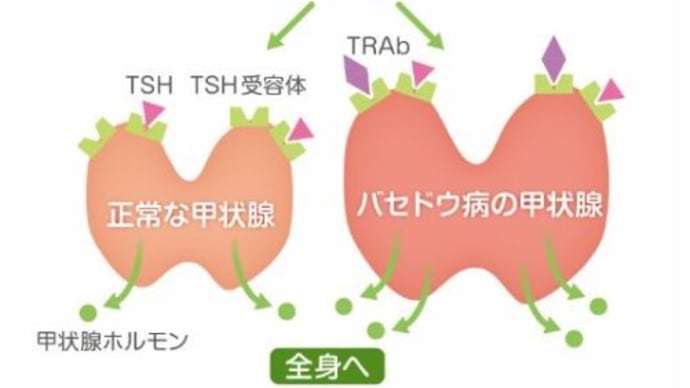 新型コロナワクチンが甲状腺機能に影響を与える(2)