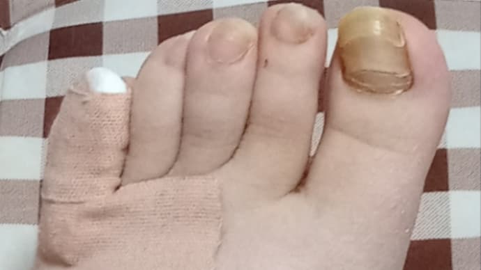 明日は…私が🏥病院…😨😨😨