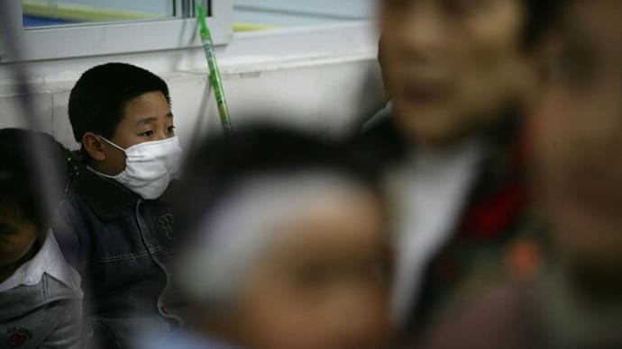 中国 マイコプラズマ肺炎と診断された8歳児 脳幹梗塞で手術