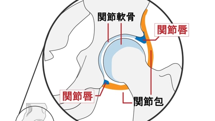 軟骨がすり減ると困ります?④股関節周りは大切!