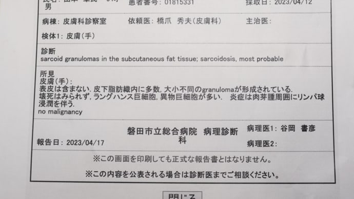 サルコイドーシスの診断下る