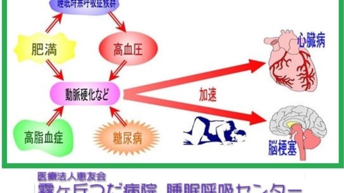 ◆いびき 睡眠時無呼吸への対処 シーパップ/一晩の 無呼吸の回数89回。低呼吸の回数182回。最長無呼吸時間49.5秒。睡眠中の1時間あたり回数31.6回。血中酸素90%未満の合計時間24分