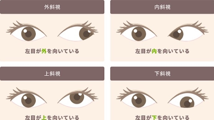 物の見え方