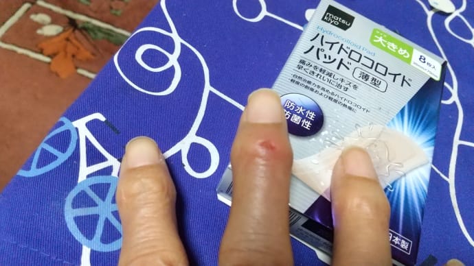 右手中指が痛い