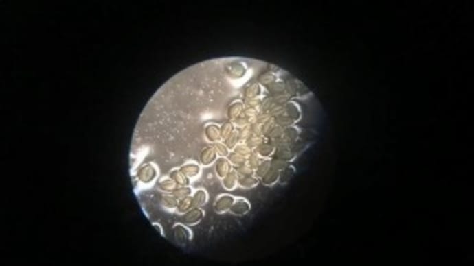 レンズの向こうに宇宙が見える！