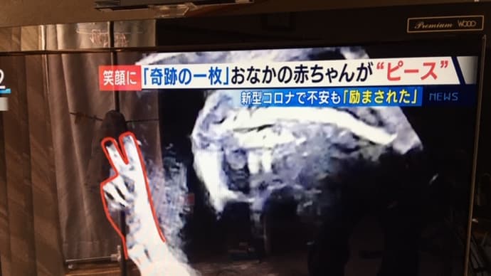 おなかの赤ちゃんからピースサイン