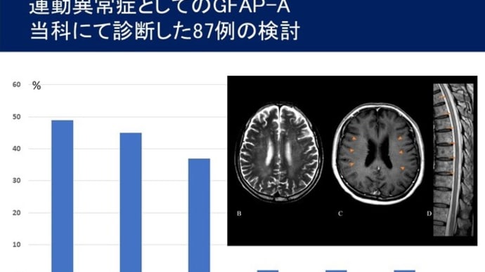 自己免疫性GFAPアストロサイトパチーでは高頻度に運動異常症（運動失調，振戦，ミオクローヌス）を呈する