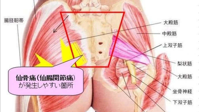 種山先生の診断と硬膜外ブロック注射