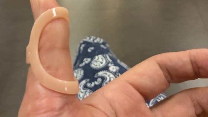 長母指伸筋腱皮下断裂手術・ 4週間後