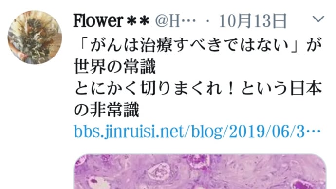 癌は治療すべきではない!が世界の常識!とにかく切りまくれ!という日本の非常識!ガンはただの【できもの】食事などで体調をよくすれば自然に消える!手術・放射線・抗癌剤とやると死ぬことになる!