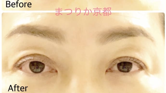 ラッシュリフト&美眉アイブロウ
