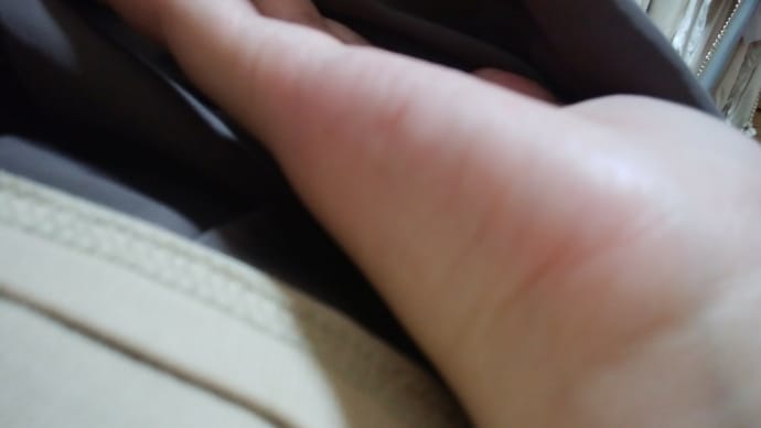 疥癬に怯える