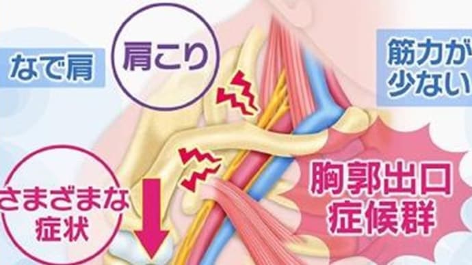 肩こりが女性に多いと言うことは・・。