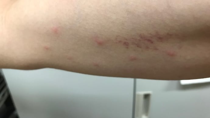 チャドクガに注意