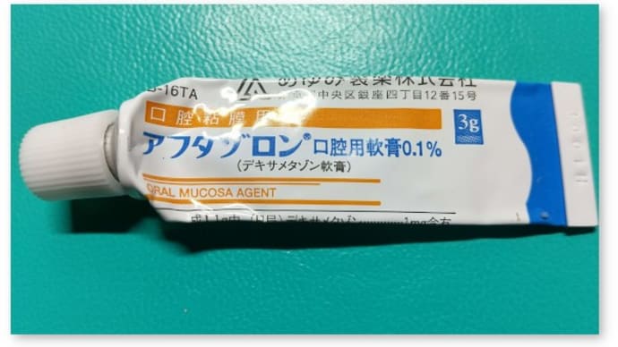「親知らず」抜歯手術のその後~経過と留意点