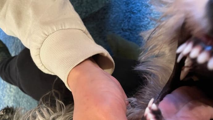 犬歯が生えてきた