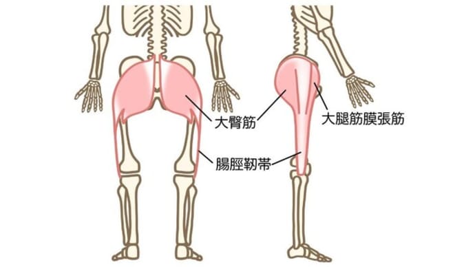 脊柱管狭窄症の治し方:太ももの外側の痛みには大腿筋膜張筋のセルフケア