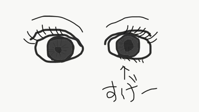 眼底検査