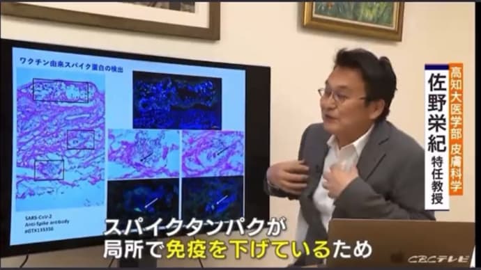 【佐野特任教授】ワクチンを接種している人の方がコロナに罹り易い。