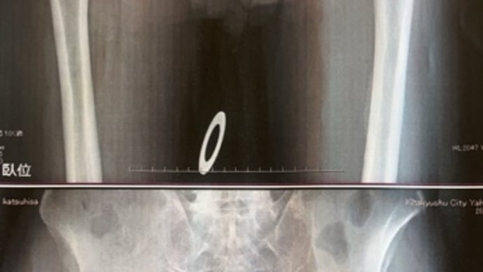 入院・手術までと現状