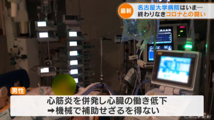 心筋炎、心筋梗塞は、明らかにコロナワクチン接種が原因で発症した病。
