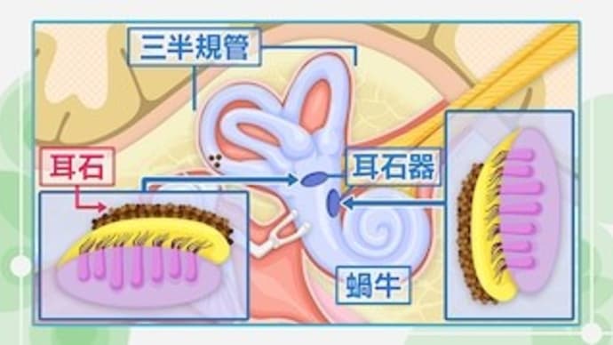 ヤバイと思って救急搬送、セーフだった。