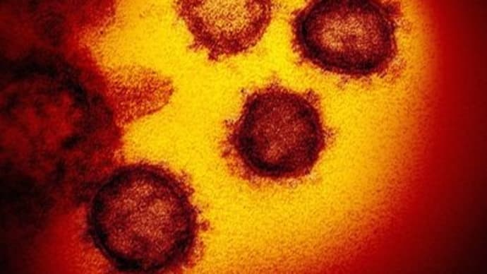 なるべく分かりやすく！コロナウイルスの事53～先週の週間陽性率は6.1％、予想外の横ばいです、やはり東アジアの感染ピークは低いのか？気になります。