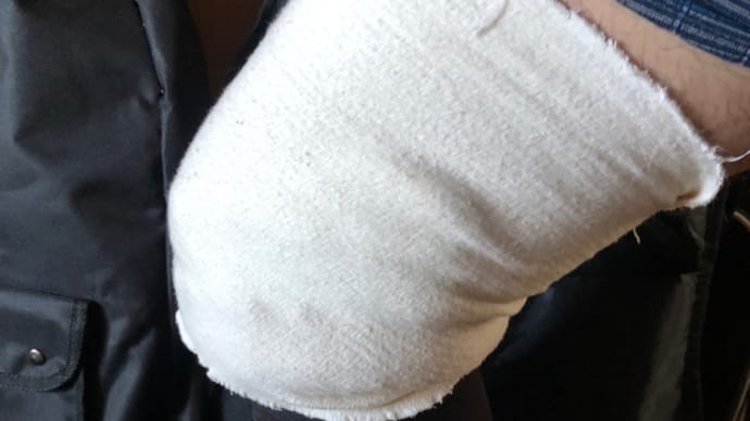 なんとか『レーザー手術』終えました………🤕🦵❤️‍🩹🏥
