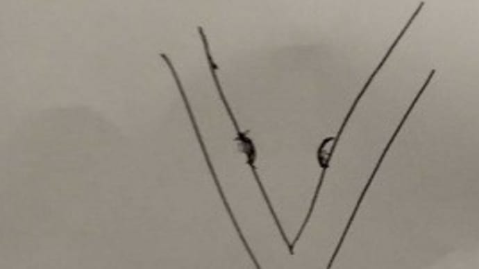 睡眠時無呼吸症候群の検査結果