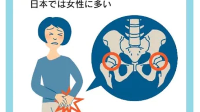 股関節の痛み、放置は禁物　「骨盤回し」で筋肉鍛え対策（日経新聞）